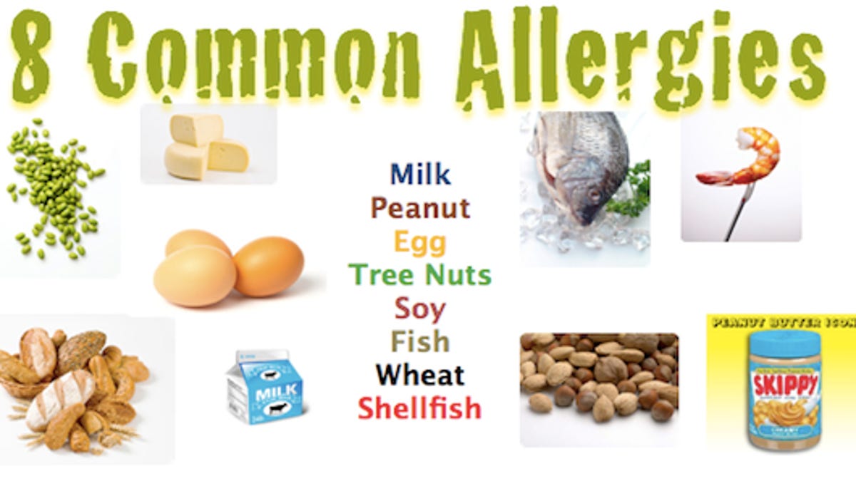 Here are the 8 most common allergies to food